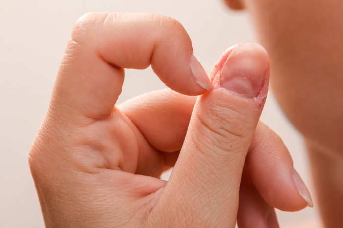 Травмированный женский палец